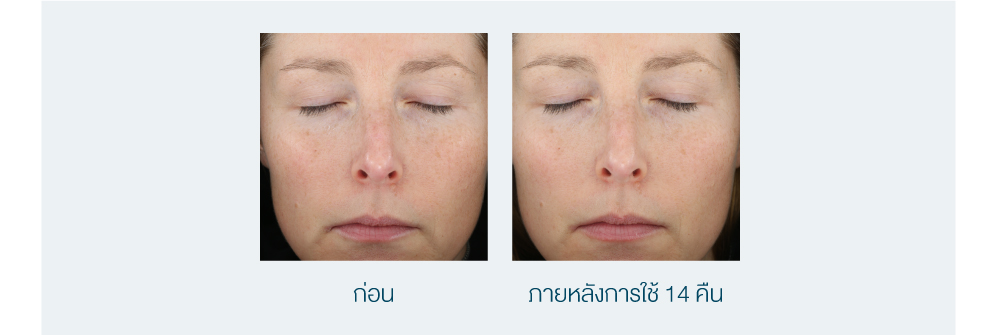 Artistry-14-Nights-Reset-Program