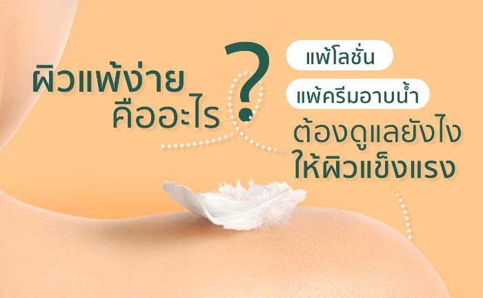 ผิวแพ้ง่าย แพ้โลชั่น ทำยังไง?