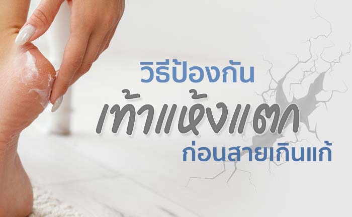 เท้าแห้งแตก